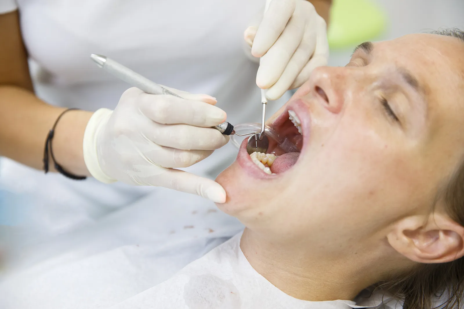 How Often Should You Get a Dental Cleaning? FAQ and Expert Advice