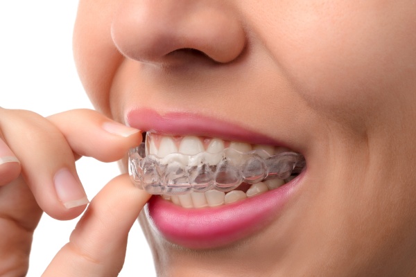 Unveiling the Clear Path to Your Perfect Smile: The Wonders of Invisalign