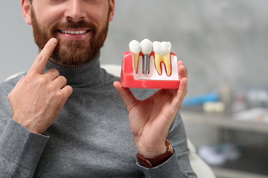 Tips for Dental Implant Recovery