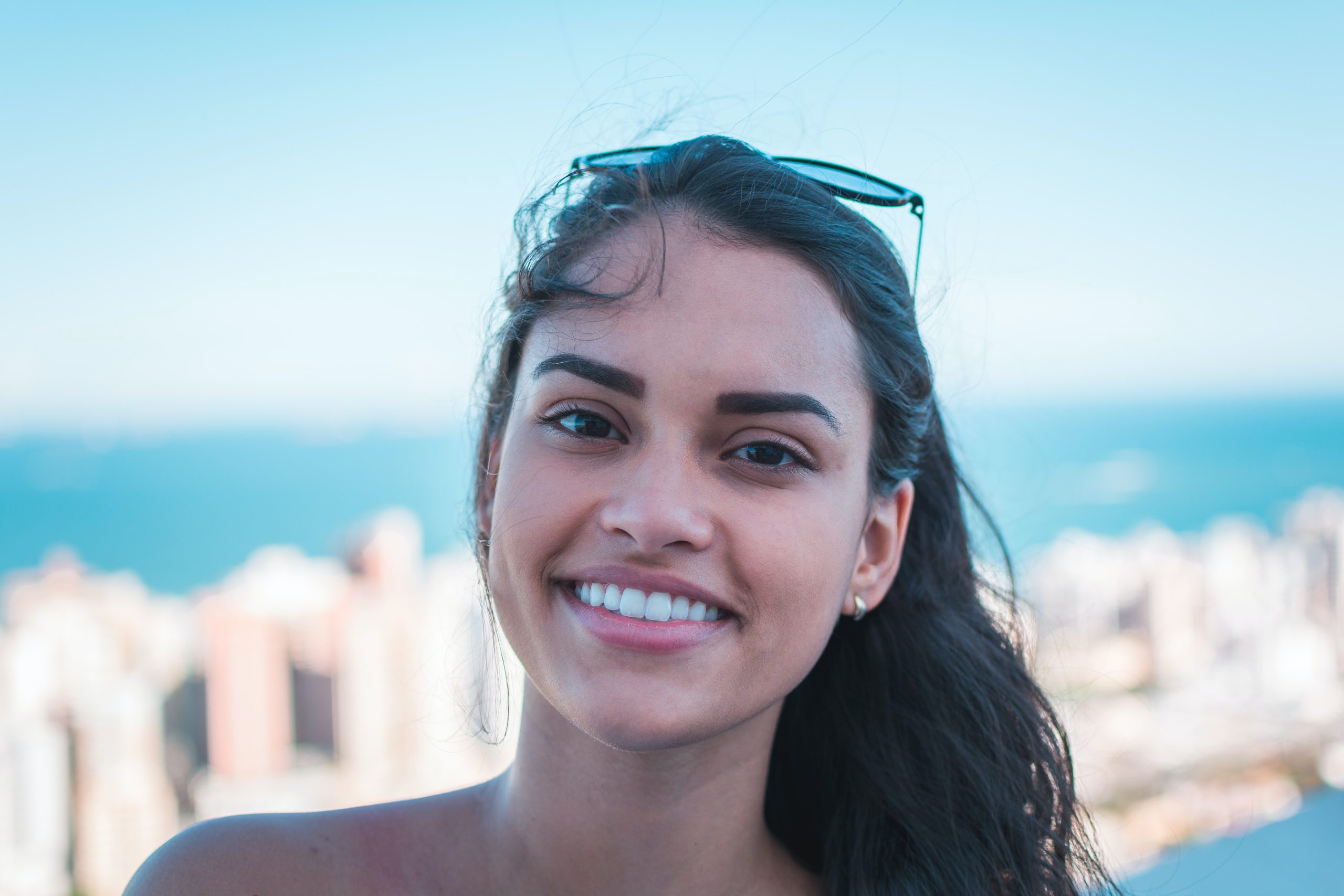 Transform Your Smile with Veneers