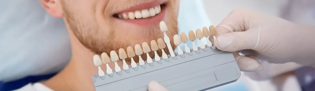 Veneers in Woodstock GA