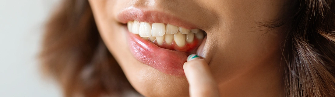 Gum Disease Therapy in Woodstock GA